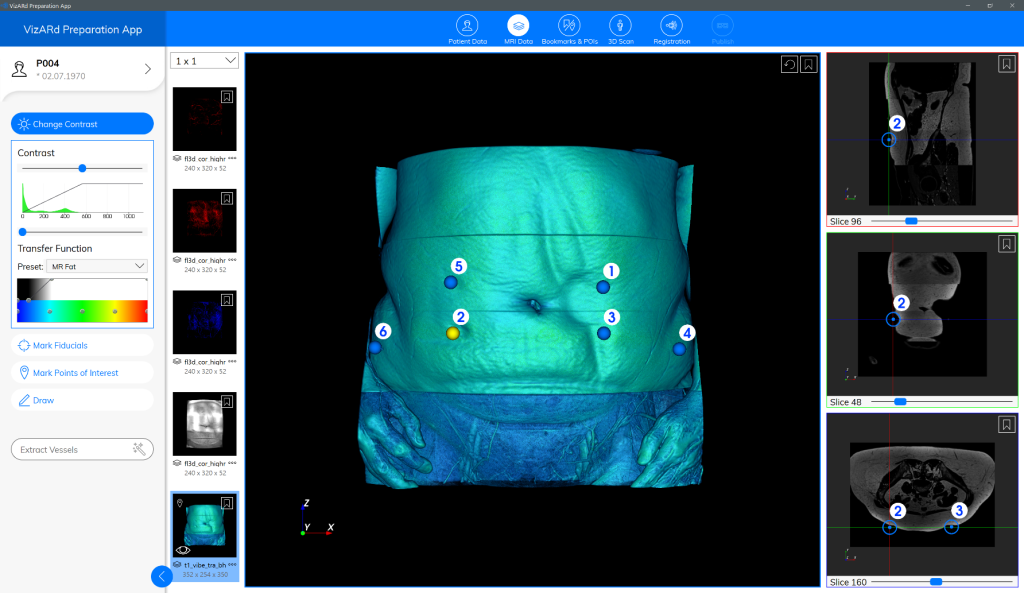 Screenshot 3D MR data processing