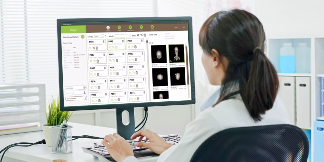 How software helps doctors analyze brain aneurysms